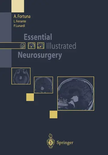 Cover of Essential Illustrated Neurosurgery