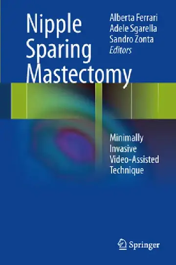 Cover of Nipple Sparing Mastectomy