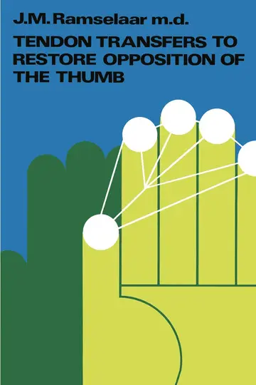 Cover of Tendon Transfers to Restore Opposition of the Thumb