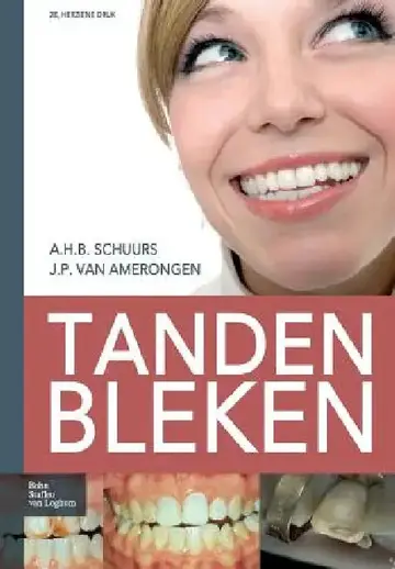 Cover of Tanden Bleken