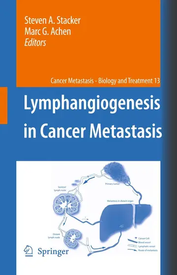 Cover of Lymphangiogenesis in Cancer Metastasis