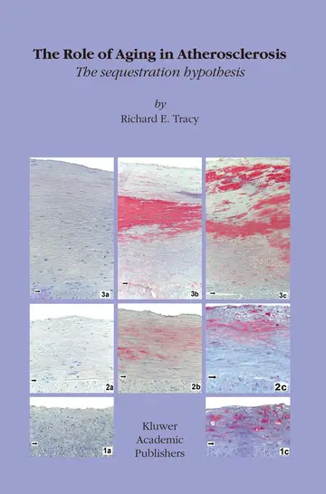 Cover of The Role of Aging in Atherosclerosis