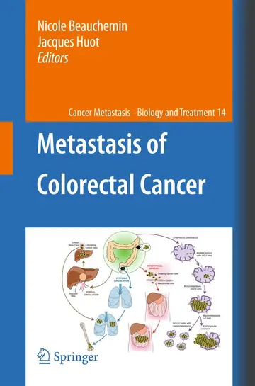 Cover of Metastasis of Colorectal Cancer