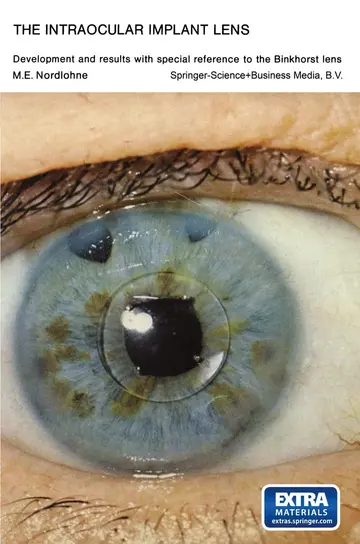 Cover of The Intraocular Implant Lens Development and Results with Special Reference to the Binkhorst Lens
