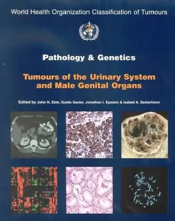 Cover of Pathology & Genetics Tumours Of The Urinary System And Male Genital Organs Who Classification Of Tum
