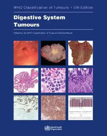 Cover of Digestive System Tumours