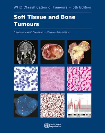 Cover of Soft Tissue and Bone Tumours