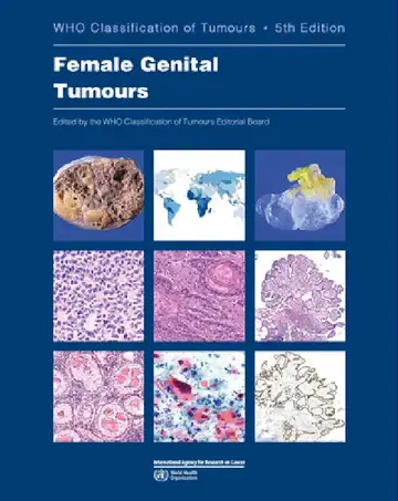 Cover of Female Genital Tumours