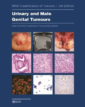 Cover of Urinary and Male Genital Tumours