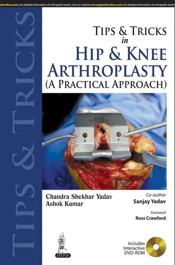 Cover of Tips and Tricks in Hip and Knee Arthroplasty