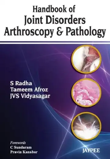 Cover of Handbook Of Joint Disorders Arthroscopy & Pathology