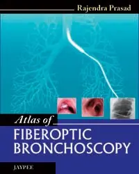 Cover of Atlas of Fiberoptic Bronchoscopy