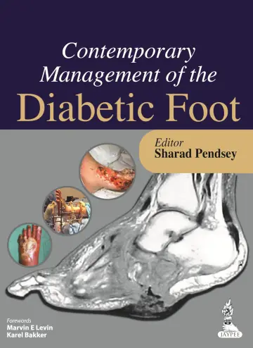 Cover of Contemporary Management of the Diabetic Foot
