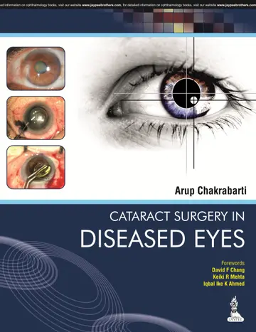 Cover of Cataract Surgery in Diseased Eyes
