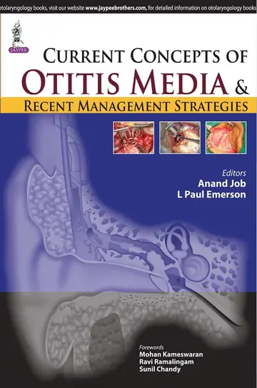 Cover of Current Concepts of Otitis Media and Recent Management Strategies