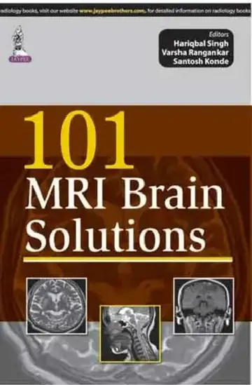 Cover of 101 Mri Brain Solutions