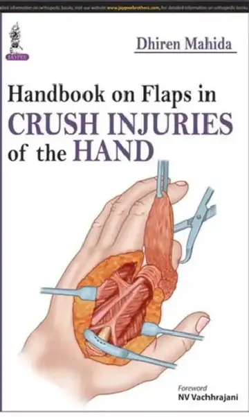 Cover of Handbook On Flaps In Crush Injuries Of The Hand
