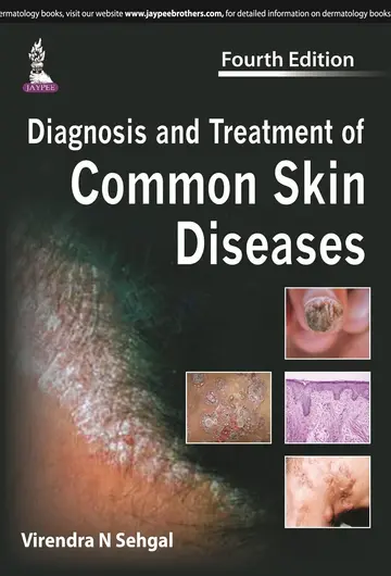 Cover of Diagnosis and Treatment of Common Skin Diseases