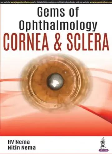 Cover of Gems Of Ophthalmology Cornea & Sclera