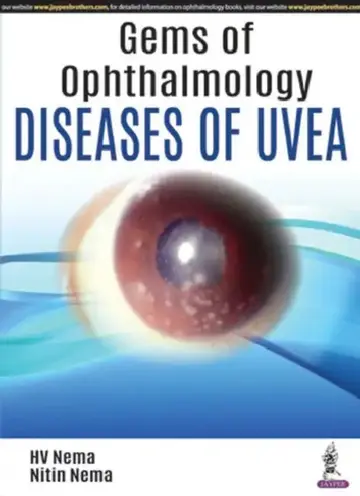 Cover of Gems Of Ophthalmology:Diseases Of Uvea