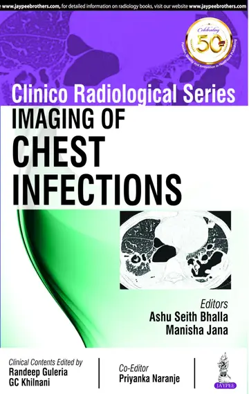 Cover of Clinico Radiological Series Imaging of Chest Infections