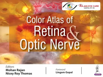 Cover of Color Atlas of Retina & Optic Nerve