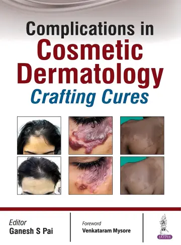 Cover of Complications in Cosmetic Dermatology