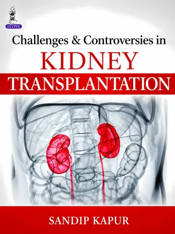 Cover of Challenges and Controversies in Kidney Transplantation