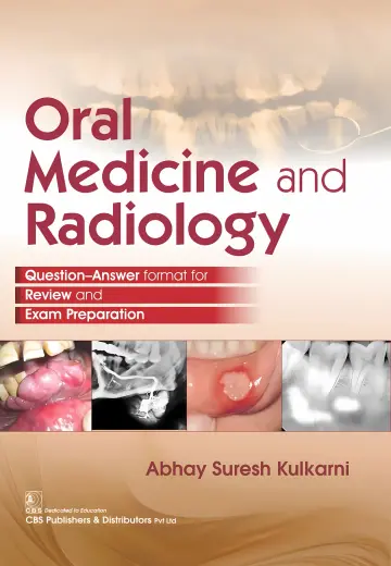 Cover of Oral Medicine and Radiology