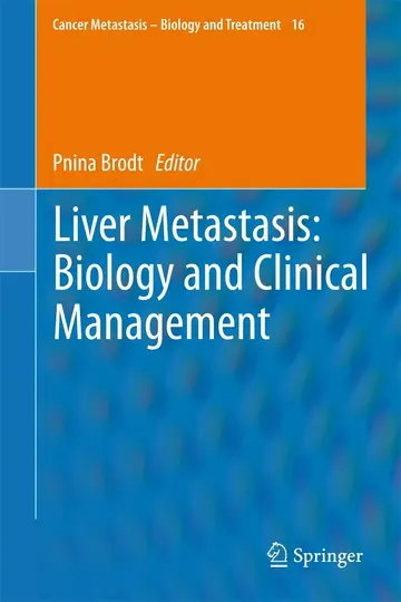 Cover of Liver Metastasis