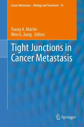 Cover of Tight Junctions in Cancer Metastasis