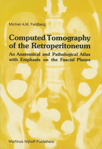 Cover of Computed Tomography of the Retroperitoneum