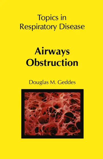 Cover of Airways Obstruction