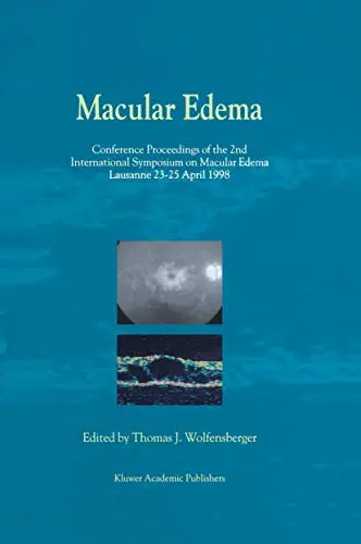 Cover of Macular Edema