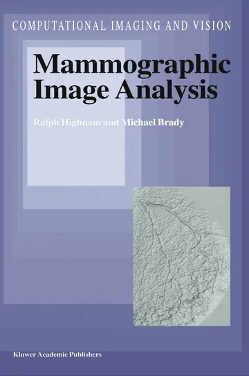 Cover of Mammographic Image Analysis