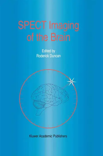 Cover of Spect Imaging of the Brain