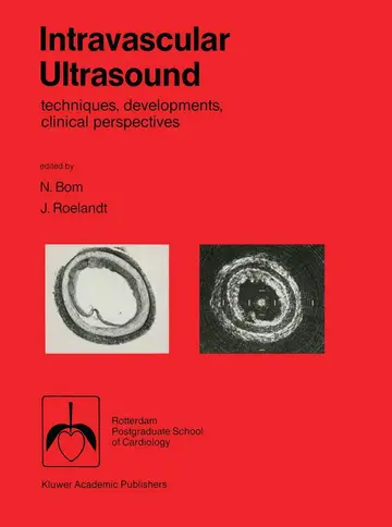 Cover of Intravascular ultrasound