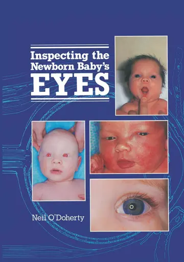 Cover of Inspecting the Newborn Baby's Eyes