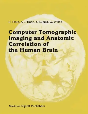 Cover of Computer Tomographic Imaging and Anatomic Correlation of the Human Brain
