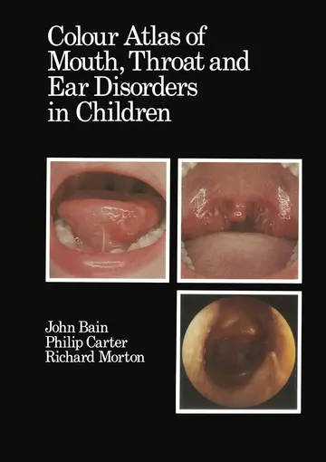 Cover of Colour Atlas of Mouth, Throat and Ear Disorders in Children
