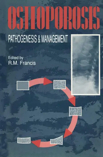 Cover of Osteoporosis