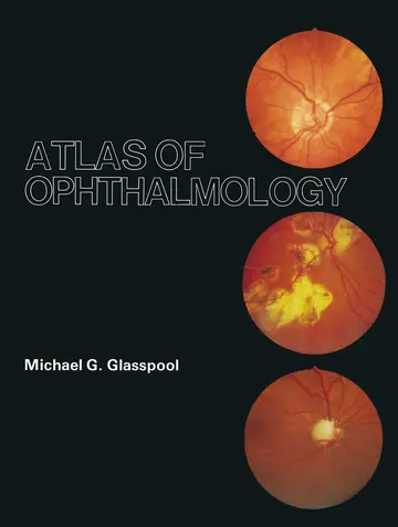 Cover of Atlas of Ophthalmology