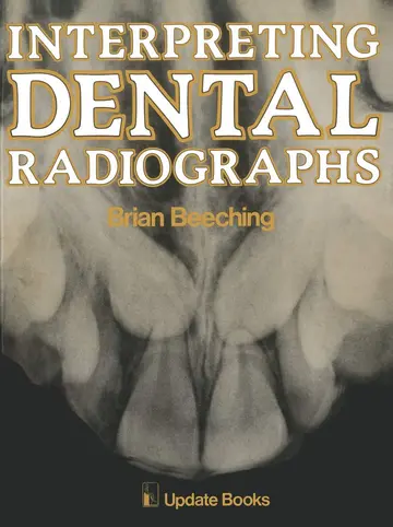 Cover of Interpreting Dental Radiographs