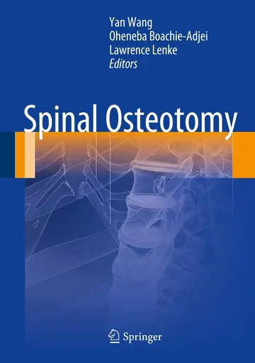 Cover of Spinal Osteotomy