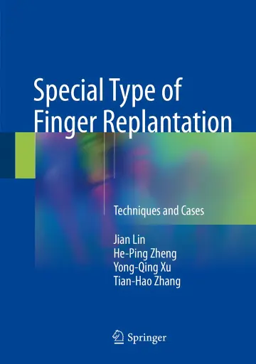 Cover of Special Type of Finger Replantation
