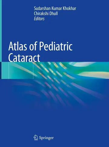 Cover of Atlas of Pediatric Cataract