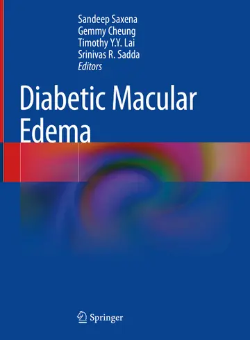 Cover of Diabetic Macular Edema