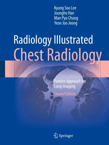 Cover of Radiology Illustrated - Chest Radiology - Pattern Approach for Lung Imaging, 2e (Feb 10, 2024)_(9819966329)_