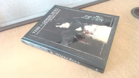 Cover of This Is Gonna Hurt