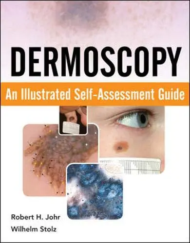 Cover of Dermoscopy